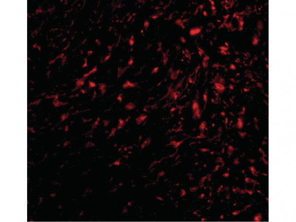 Anti-TEM5