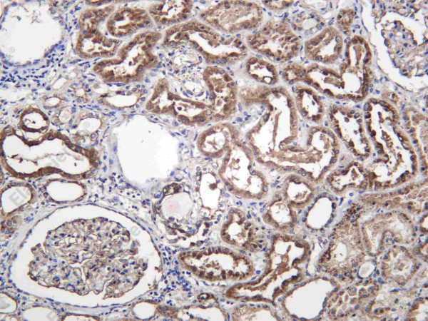 Anti-Recombinant SCRB2, clone C112557