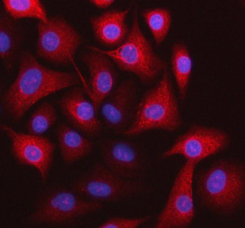 Anti-STOML3 / Stomatin-like protein 3