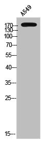 Anti-Phospho-SGK223 (Y413)