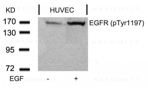 Anti-phospho-EGFR(Tyr1197) Antibody