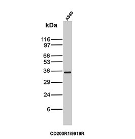 Anti-CD200R1 / OX-2 receptor, clone CD200R1/9919R