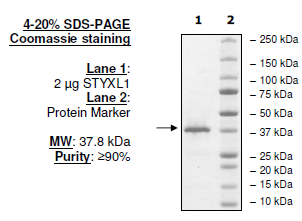 STYXL1, N-terminal FLAG-tag, human recombinant protein