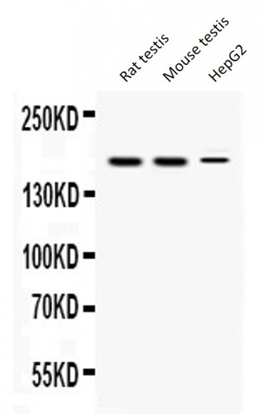 Anti-KDM5B / Jarid1B