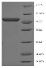 Phosphoserine aminotransferase (Psat1), mouse, recombinant