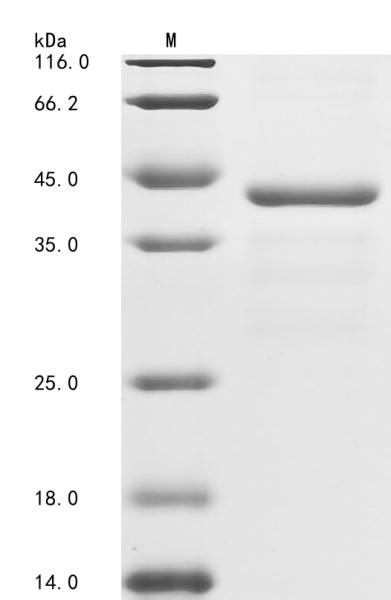 Coagulation factor IX (F9), partial, human, recombinant