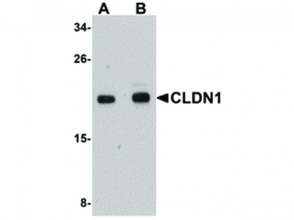 Anti-CLDN1