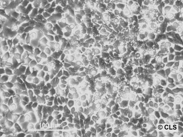 A673 Cells