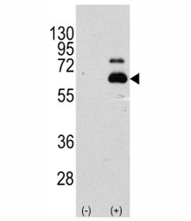 Anti-p70 S6 Kinase