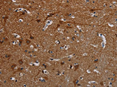 Anti-PCDHB15