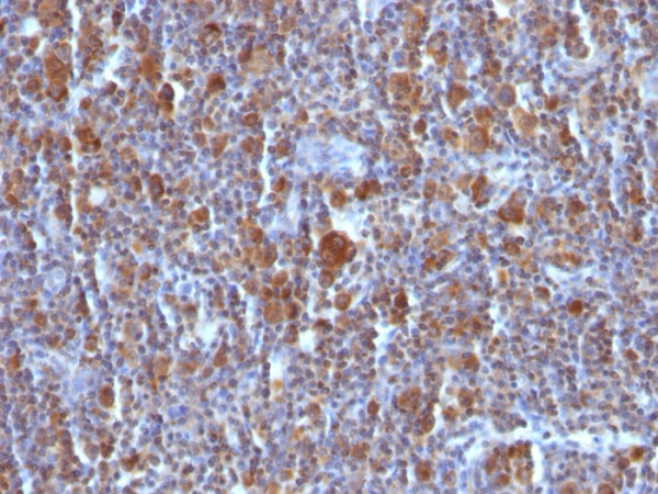 Anti-Bax (Apoptosis Marker), clone BAX/962