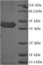 CUE domain-containing protein 2 (CUEDC2), partial, human, recombinant