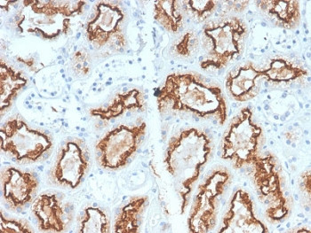 Anti-CA9 / Carbonic Anhydrase IX, clone CA9/2993R