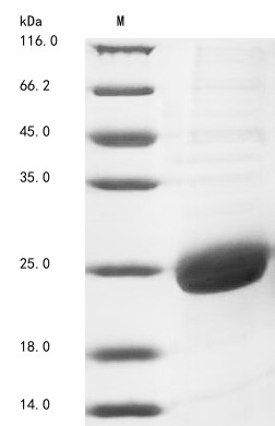 Proteoglycan 4 (PRG4), partial, human, recombinant