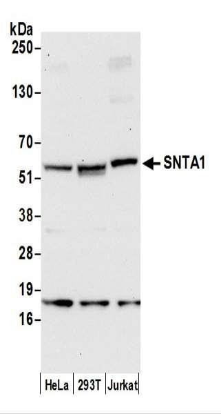 Anti-SNTA1