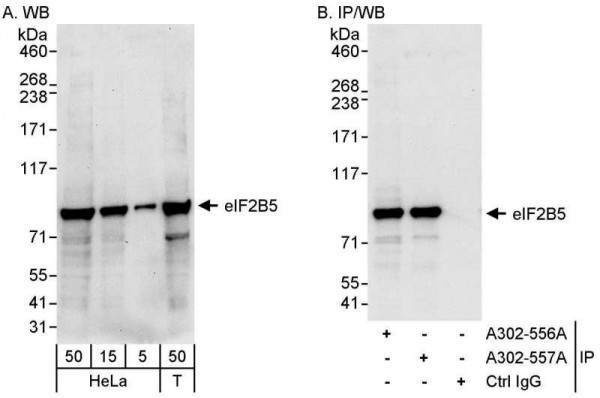 Anti-eIF2B5