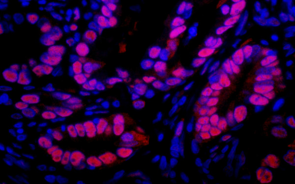 Anti-Rabbit IgG-heavy and light chain, DyLight(R) 594 conjugated