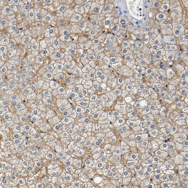 Anti-SLCO2B1