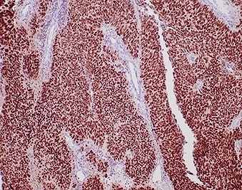 Anti-GATA3, clone rGATA3/3870