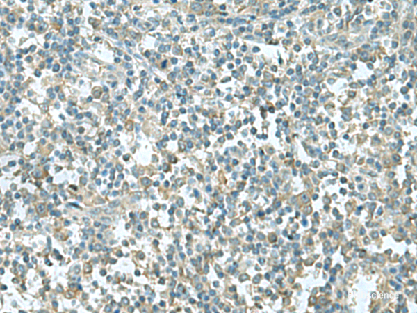 Anti-CCT5