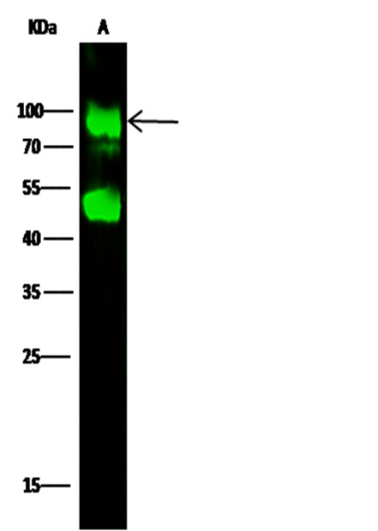 Anti-Glucosamine (N-acetyl)-6-Sulfatase/G6S Monoclonal Recombinant Antibody