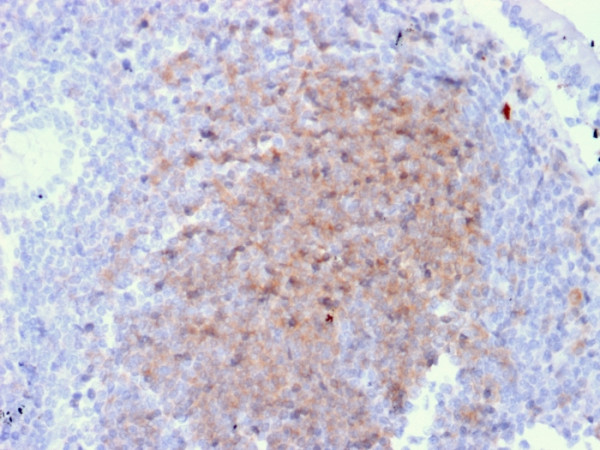 Anti-CD72 (B Cell Marker), clone BU40
