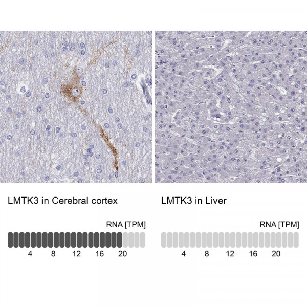 Anti-LMTK3