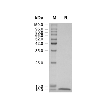 HCC-1 (CCL14) Recombinant (Human)