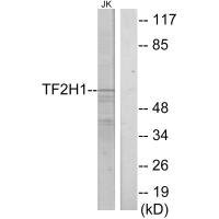 Anti-GTF2H1