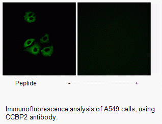 Anti-CCBP2