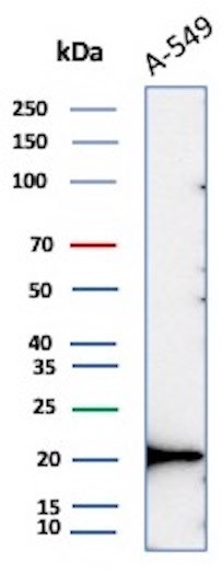Anti-Bax (Apoptosis Marker), recombinant antibody, clone BAX/8960R
