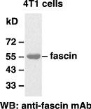 Anti-Fascin, monoclonal