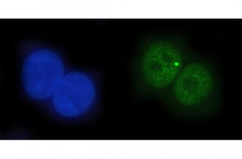 Anti-EAP2 / ETS1 associated protein II / Tyrosyl-DNA phosphodiesterase 2