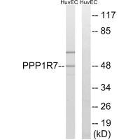 Anti-PPP1R7