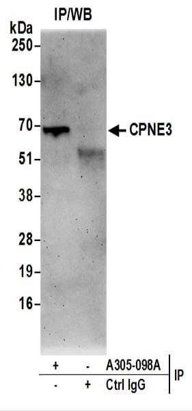 Anti-CPNE3/Copine 3