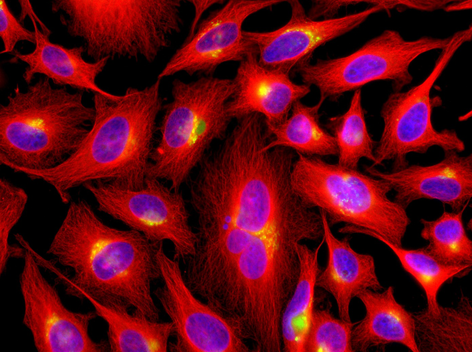 Anti-beta-Tubulin, mAb (rec.), clone S11B