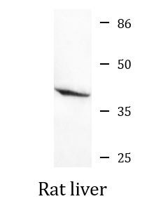 Anti-AMACR, clone 2F3-C11-B12, C-terminal