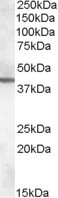 Anti-ABHD12, C-terminal