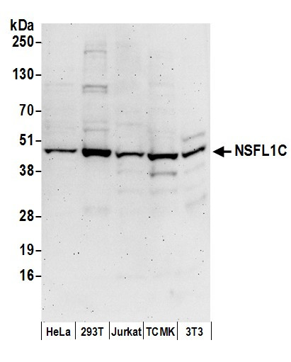 Anti-NSFL1C