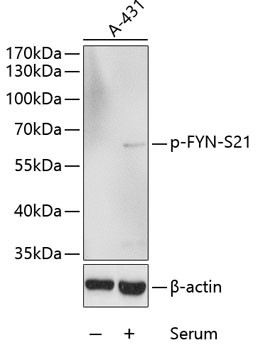 Anti-phospho-FYN-S21