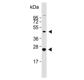 Anti-HABP2 / Hyaluronan-binding protein 2