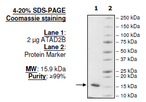 ATAD2B (953-1080), human recombinant protein