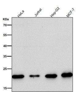 Anti-MRPL11 / Mitochondrial ribosomal protein L11, clone 32M78