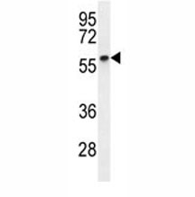 Anti-Cyclin B1 (CCNB1)