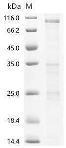 Transient receptor potential cation channel subfamily V member 6 (Trpv6), recombinant mouse