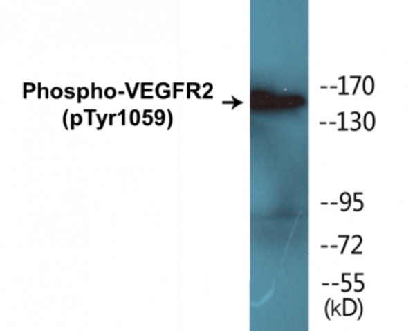 VEGFR2 (Phospho-Tyr1059) Colorimetric Cell-Based ELISA Kit