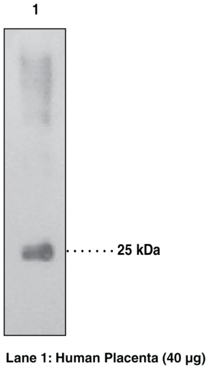 Anti-15-hydroxy Prostaglandin Dehydrogenase