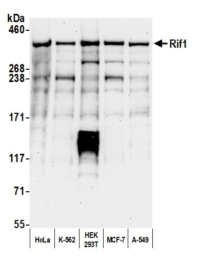 Anti-RIF1