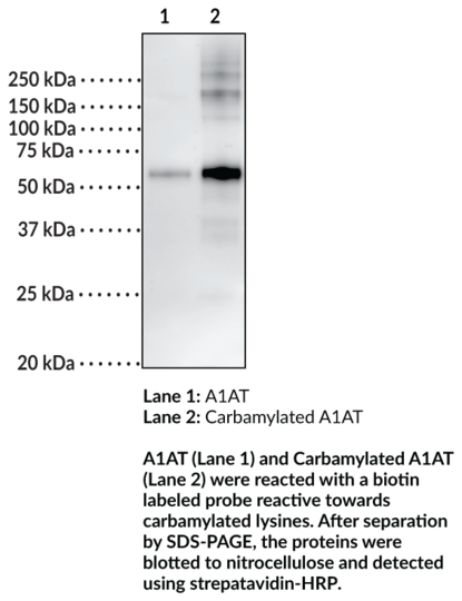 Carbamylated Alpha-1 Antitrypsin