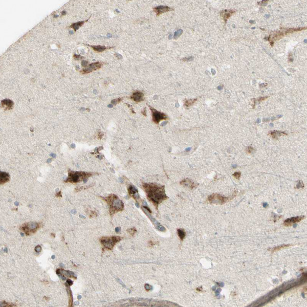 Anti-NDFIP1